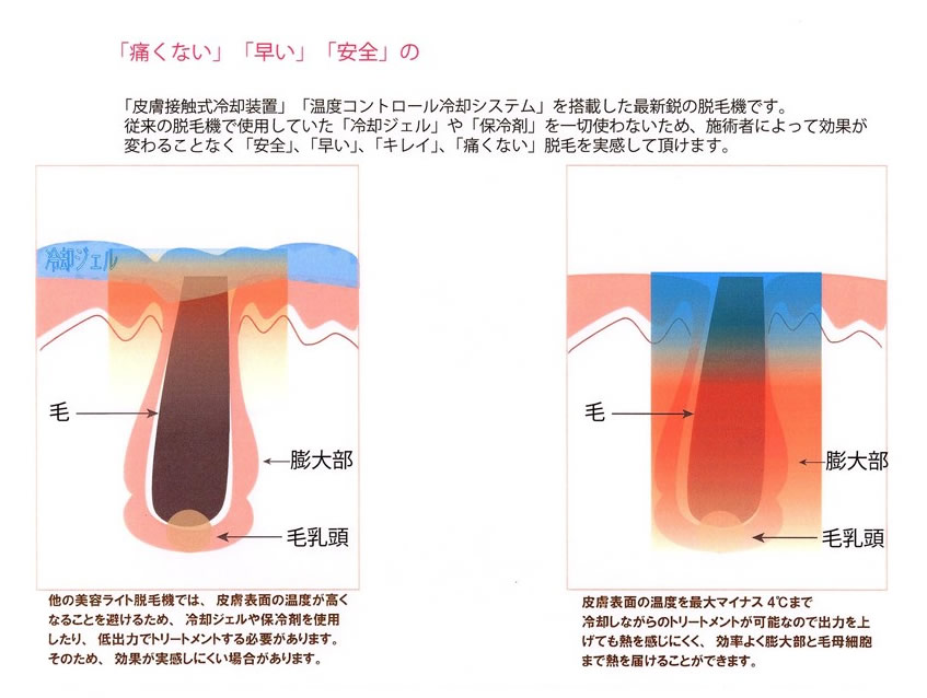 禁忌事項・注意事項について